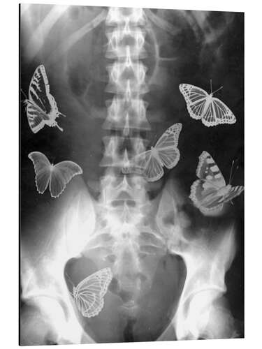 Aluminium print Butterflies in the stomach