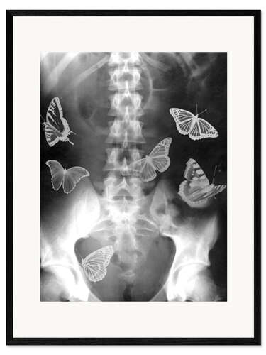 Framed art print Butterflies in the stomach