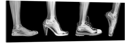 Cuadro de metacrilato Diferentes zapatos, radiografía