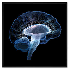 Gerahmter Kunstdruck Nerven-Netzwerk