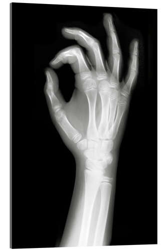 Cuadro de metacrilato Radiografía OK