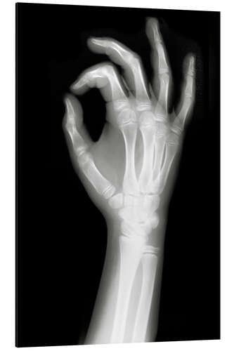 Aluminiumsbilde X rayed OK sign