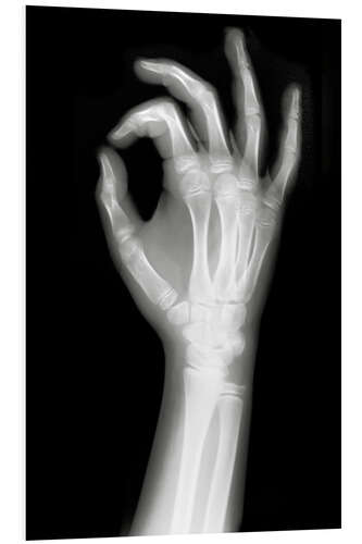 PVC-tavla X rayed OK sign