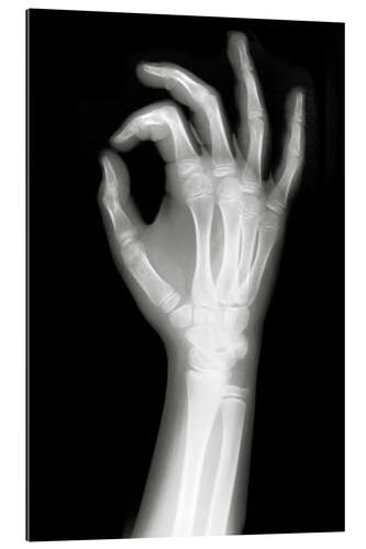 Galleritryck X rayed OK sign