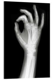 Galleritryk X rayed OK sign