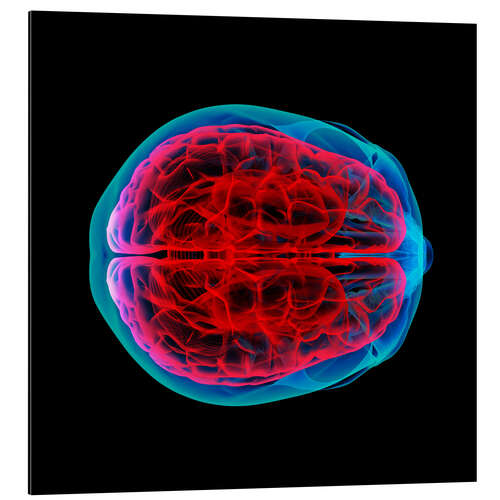 Aluminiumsbilde Brain perfusion