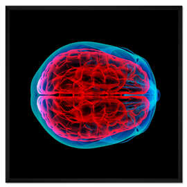 Gerahmter Kunstdruck Durchblutung des Gehirns