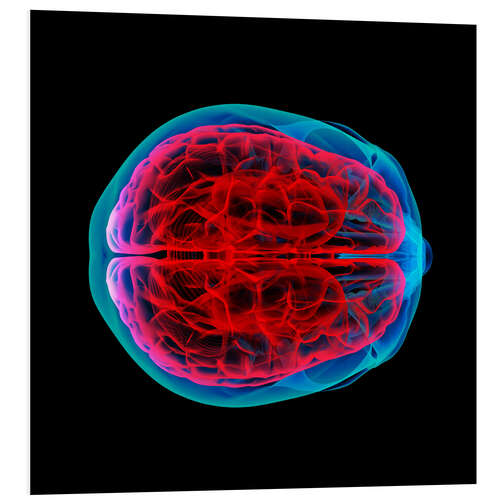 Bilde på skumplate Brain perfusion