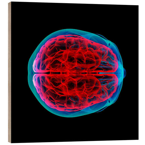 Wood print Brain perfusion