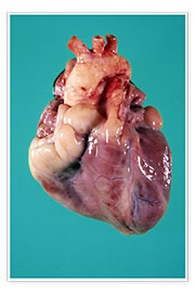 Poster Human heart