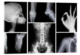 Akryylilasitaulu X-rays of the human body