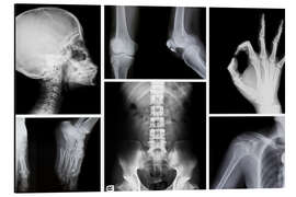 Cuadro de aluminio Radiografía de un cuerpo humano