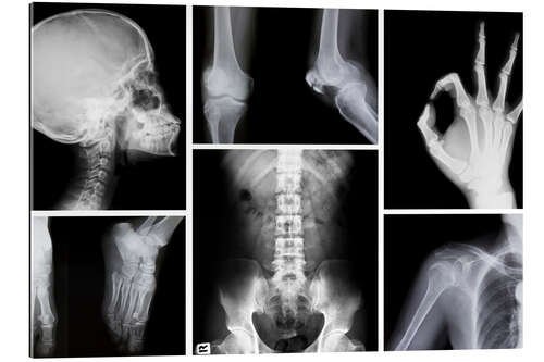 Stampa su plexi-alluminio Radiografia del corpo umano