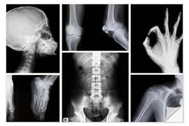 Sisustustarra X-rays of the human body