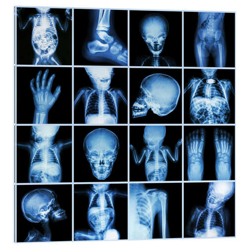 Akrylbillede Xrays of a child body