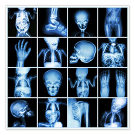 Poster Corps d'enfant aux rayons X