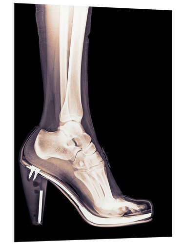 Quadro em PVC high heel shoe X-ray