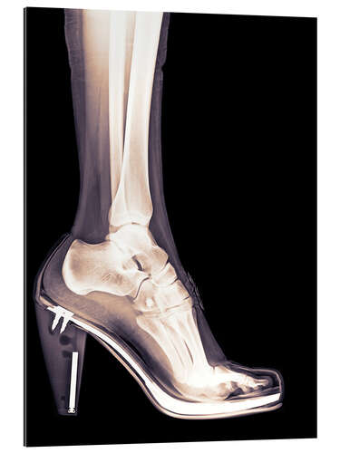 Galleritryk high heel shoe X-ray