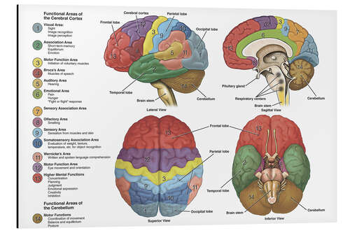 Stampa su alluminio Il cervello da 4 prospettive