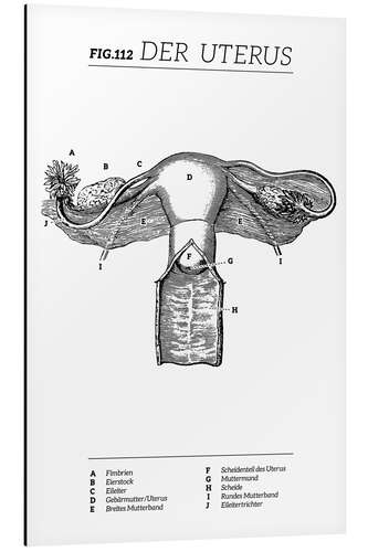 Alumiinitaulu Vintage Uterus Diagram (German)