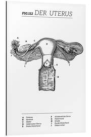 Alubild Der Uterus, Diagramm (Vintage)