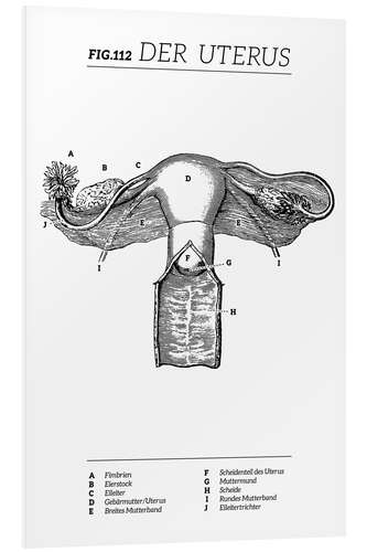 Hartschaumbild Der Uterus, Diagramm (Vintage)