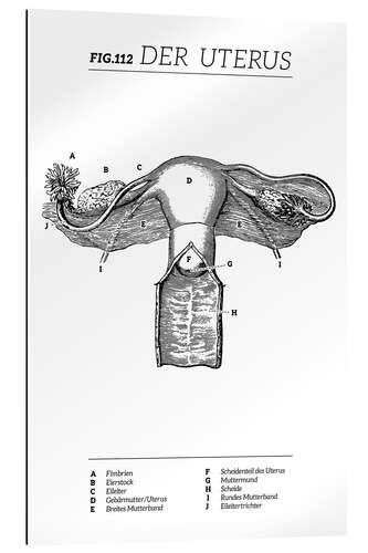Quadro em plexi-alumínio Diagrama do útero vintage (alemão)