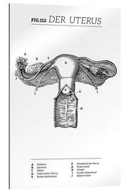 Gallery Print Der Uterus, Diagramm (Vintage)