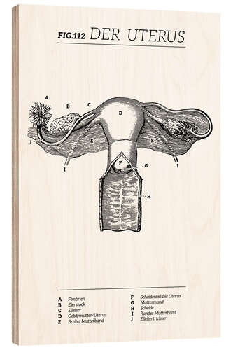 Wood print Vintage Uterus Diagram (German)