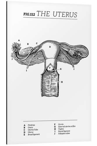 Aluminiumsbilde Uterus Vintage Chart