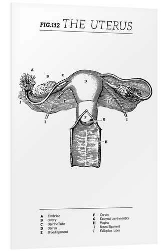 Bilde på skumplate Uterus Vintage Chart