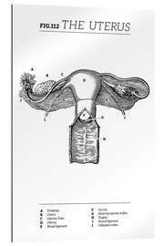 Tableau en plexi-alu L&#039;utérus (anglais)