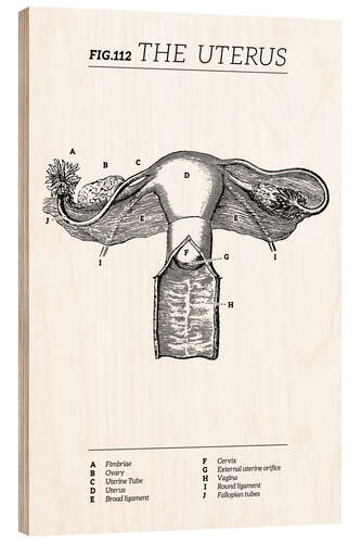 Wood print Uterus Vintage Chart