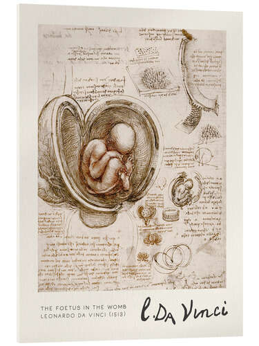 Quadro em acrílico The Foetus in the Womb